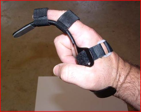 Adaptive Outdoorsman Trigger Finger Prosthetic